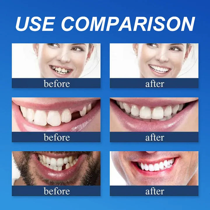 Ends Today: 58% OFF! ⏰58% OFF! EETTSY™ Medical Full Denture with Strong Suctiond Custom-Fit Full Functional Dentures🦷Obtain American Dental Association (ADA) Certification
